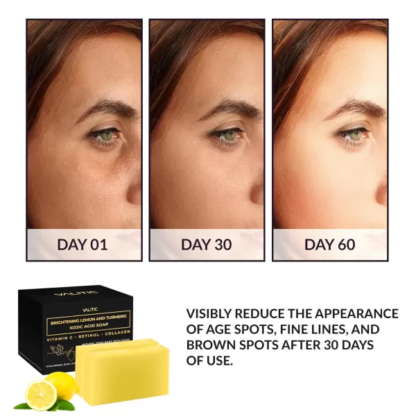 VALITIC Brightening Lemon ampamp Turmeric Kojic Acid Soap with Vitamin C Retinol Collagen  Original Japanese Complex Infused with Hyaluronic Acid Vitamin E Shea Butter Castile Olive Oil 2 Pack2 Pack  Holder