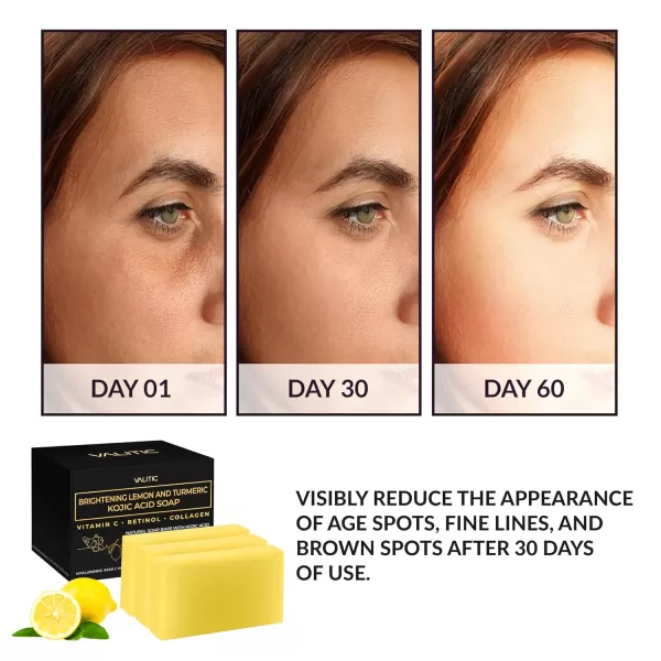 VALITIC Brightening Lemon ampamp Turmeric Kojic Acid Soap with Vitamin C Retinol Collagen  Original Japanese Complex Infused with Hyaluronic Acid Vitamin E Shea Butter Castile Olive Oil 2 Pack3 Pack
