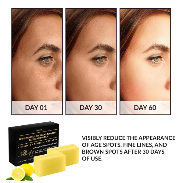 VALITIC Brightening Lemon ampamp Turmeric Kojic Acid Soap with Vitamin C Retinol Collagen  Original Japanese Complex Infused with Hyaluronic Acid Vitamin E Shea Butter Castile Olive Oil 2 Pack4 Pack
