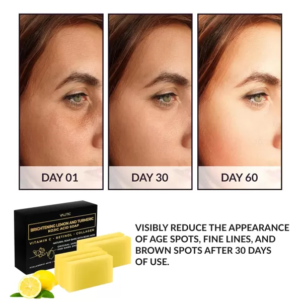 VALITIC Brightening Lemon ampamp Turmeric Kojic Acid Soap with Vitamin C Retinol Collagen  Original Japanese Complex Infused with Hyaluronic Acid Vitamin E Shea Butter Castile Olive Oil 2 Pack5 Pack