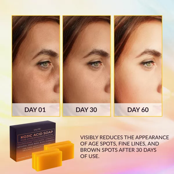 VALITIC Kojic Acid Soap for Hyperpigmentation  with Glutathione Collagen ampamp Vitamin C  Natural Soap Bars with Turmeric  Original Japanese Complex for Dark Spot Correction  2 Pack4 Pack