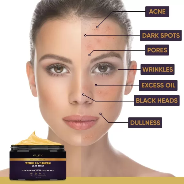 VALITIC Vitamin C ampamp Turmeric Clay Mask  Dark Spot Corrector with Kojic Acid Hyaluronic Acid ampamp Retinol  Skin Care Routine for Minimizing Pores ampamp Blackheads  with Applicator Brush  100g353 Ounce Pack of 1