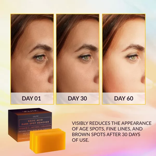 Valitic 2 Pack Kojic Acid Dark Spot Corrector Soap Bars with Vitamin C Retinol Collagen Turmeric  Original Japanese Complex with Hyaluronic Acid ampamp A Pair of Black Exfoliating Gloves for Body Scrub2 Pack Hyal Soap Bars  Exfoliating Gloves