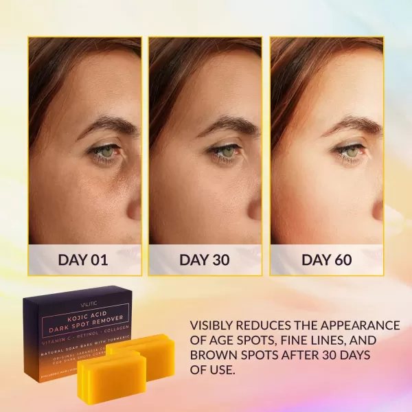 Valitic 2 Pack Kojic Acid Dark Spot Corrector Soap Bars with Vitamin C Retinol Collagen Turmeric  Original Japanese Complex with Hyaluronic Acid ampamp A Pair of Black Exfoliating Gloves for Body Scrub4 Pack Hyal Soap Bars  Exfoliating Gloves