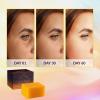 imageVALITIC Kojic Acid Vitamin C and Retinol Soap Bars with Turmeric for Dark Spot  Original Japanese Complex Infusedwith Collagen Hyaluronic Acid Vitamin E 2 Pack  With Scrub Bag3 Pack