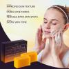 image:imageVALITIC Kojic Acid Dark Spot Corrector Soap Bars with Vitamin C Retinol Collagen Turmeric  Original Japanese Complex  Hyaluronic Acid Vitamin E Shea Butter Castile Olive Oil  2 Pack With Bag4 Pack