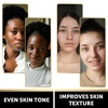 image:imageVALITIC Charcoal Kojic Acid Turmeric Black Soap Bar Dark Spot Remover for Body or Face Wash  2 Pack and Bag2 Pack  Holder